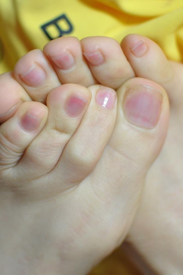 Fannie芬妮每足园 No.600 早春二月 裸足[83P/147MB]-萌图网